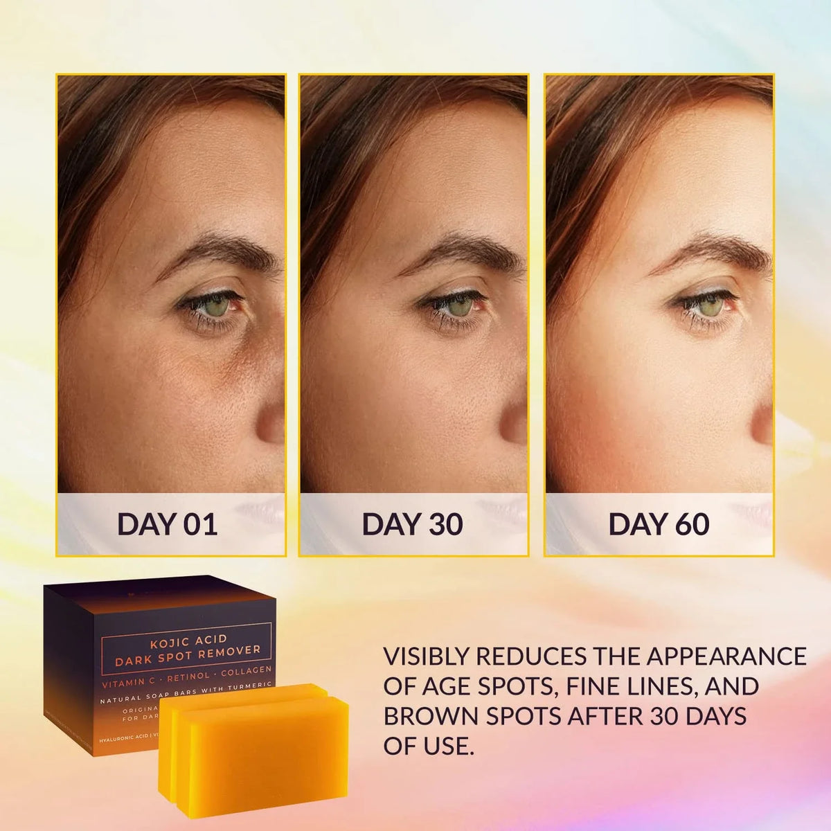 Avant et après : effet du savon au acide kojique sur les taches d'âge, les ridules et les taches brunes