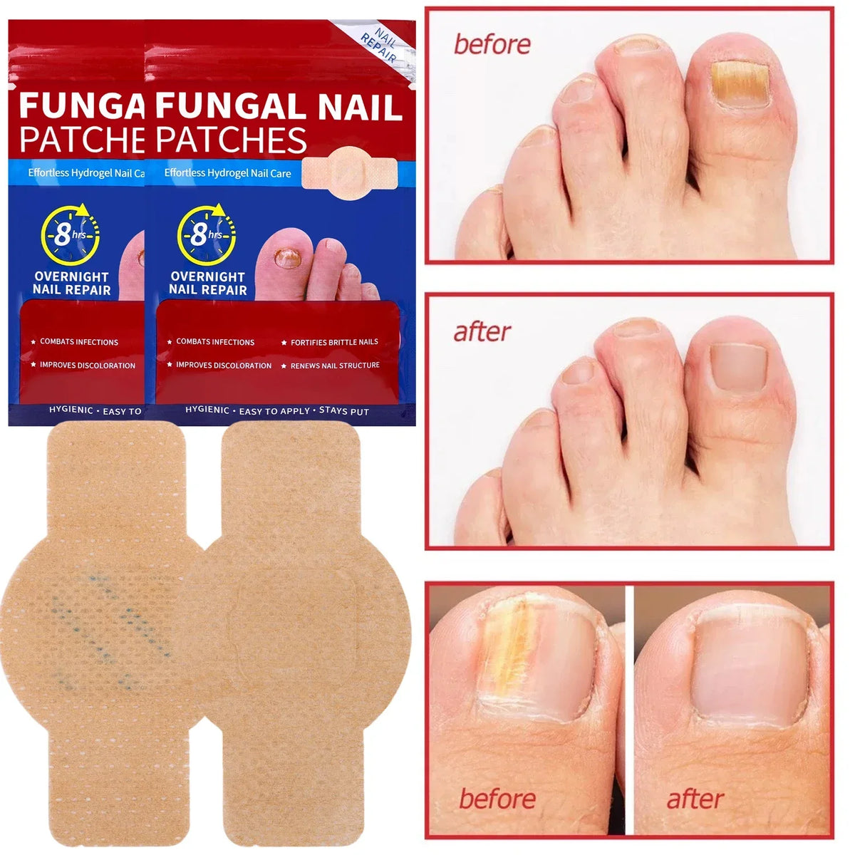 Box and application of Funga Fungal Nail Patche patches for overnight nail repair