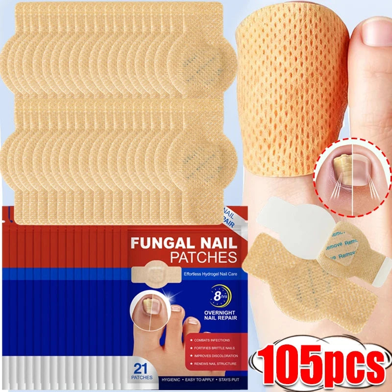 Pack of 105 fungal nail patches for overnight nail repair on the toenail