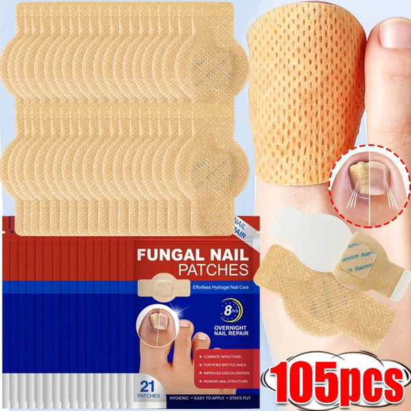 Pack of 105 fungal nail patches for overnight nail repair on the toenail