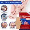 Image showing fungal nail patches and hands, illustrating care for damaged nails.