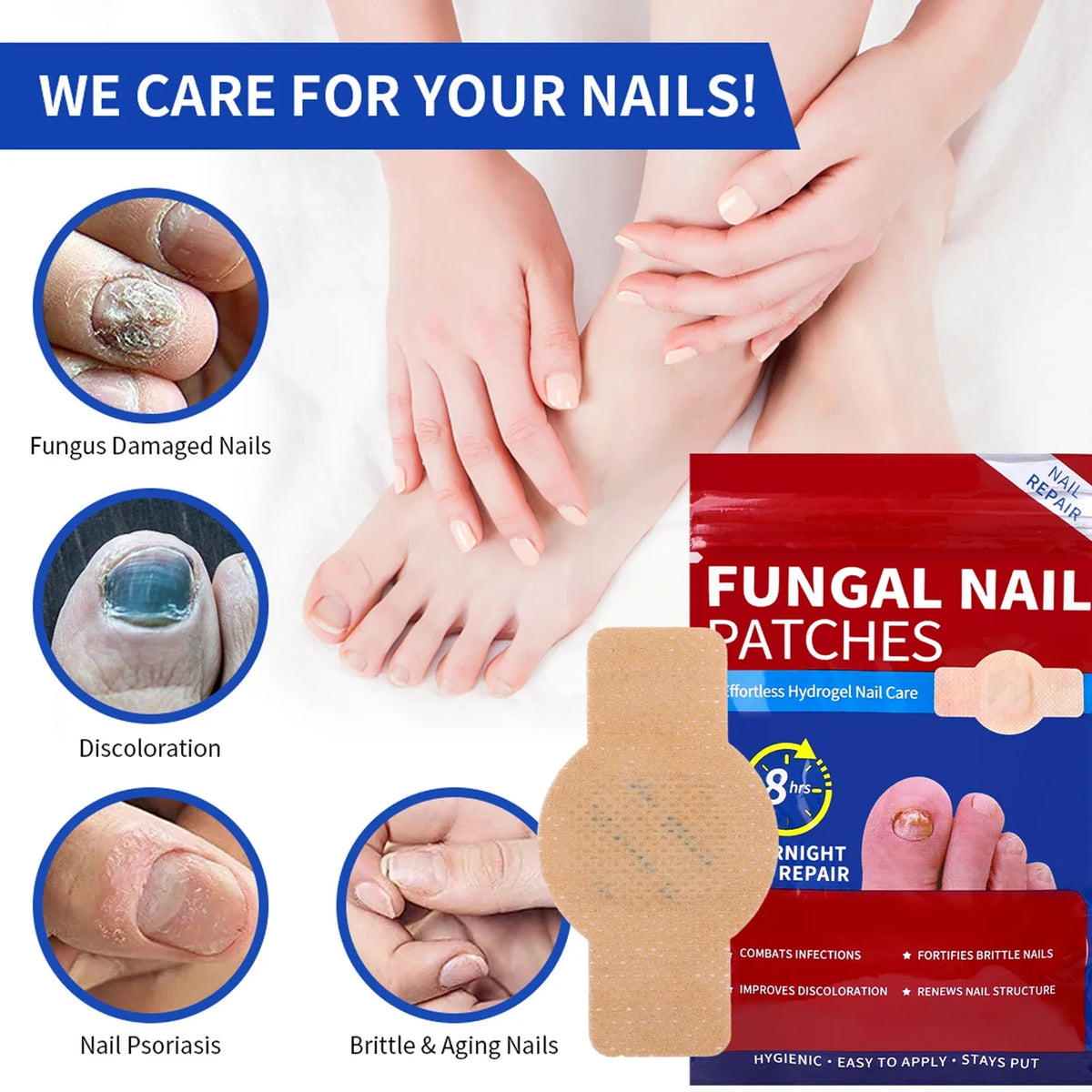 Image showing fungal nail patches and hands, illustrating care for damaged nails.
