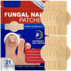 Box of 21 fungal nail patches for overnight nail repair and infection combat.