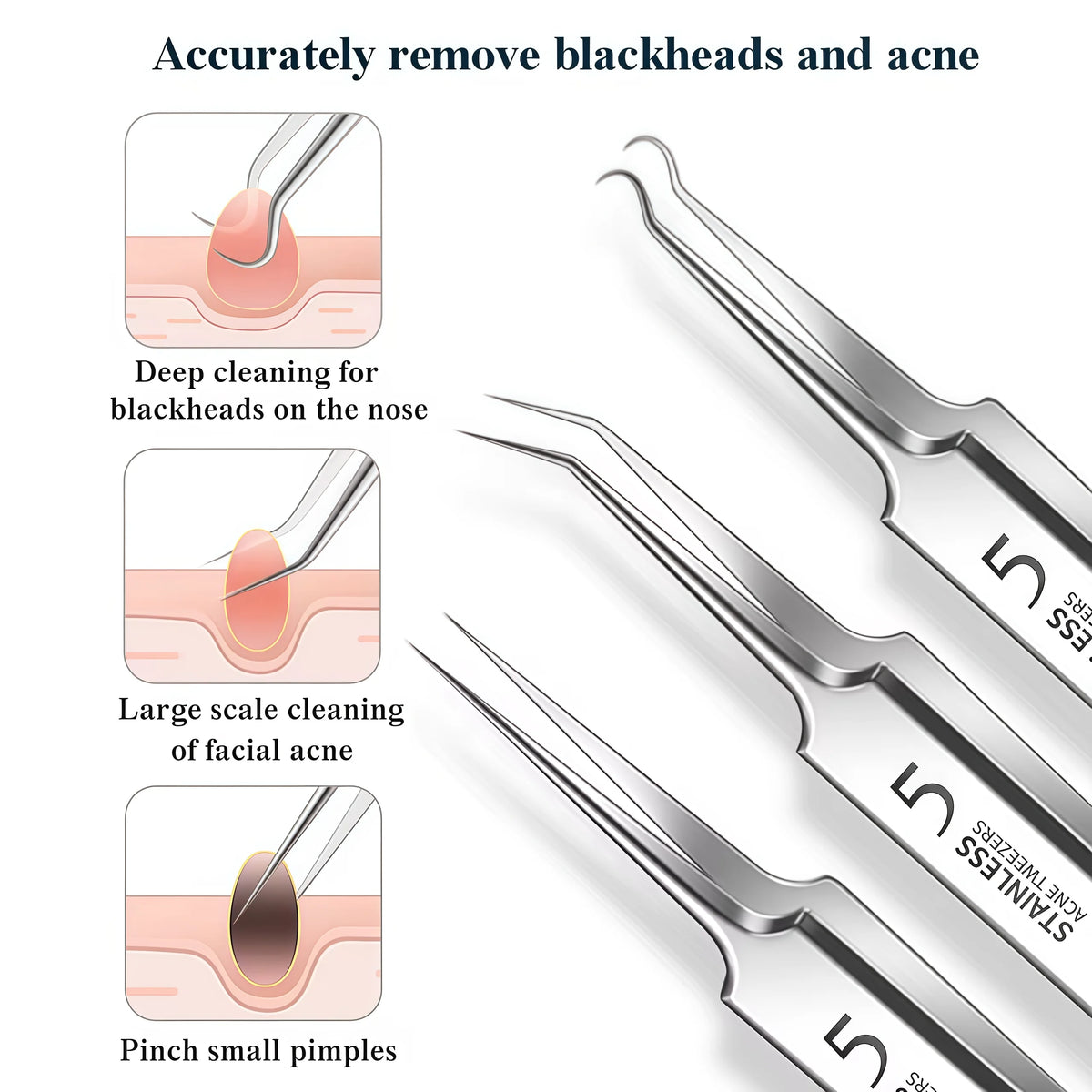 Stainless steel acne and blackhead remover kit showing tools for deep cleaning, large scale cleaning, and pinching small pimp