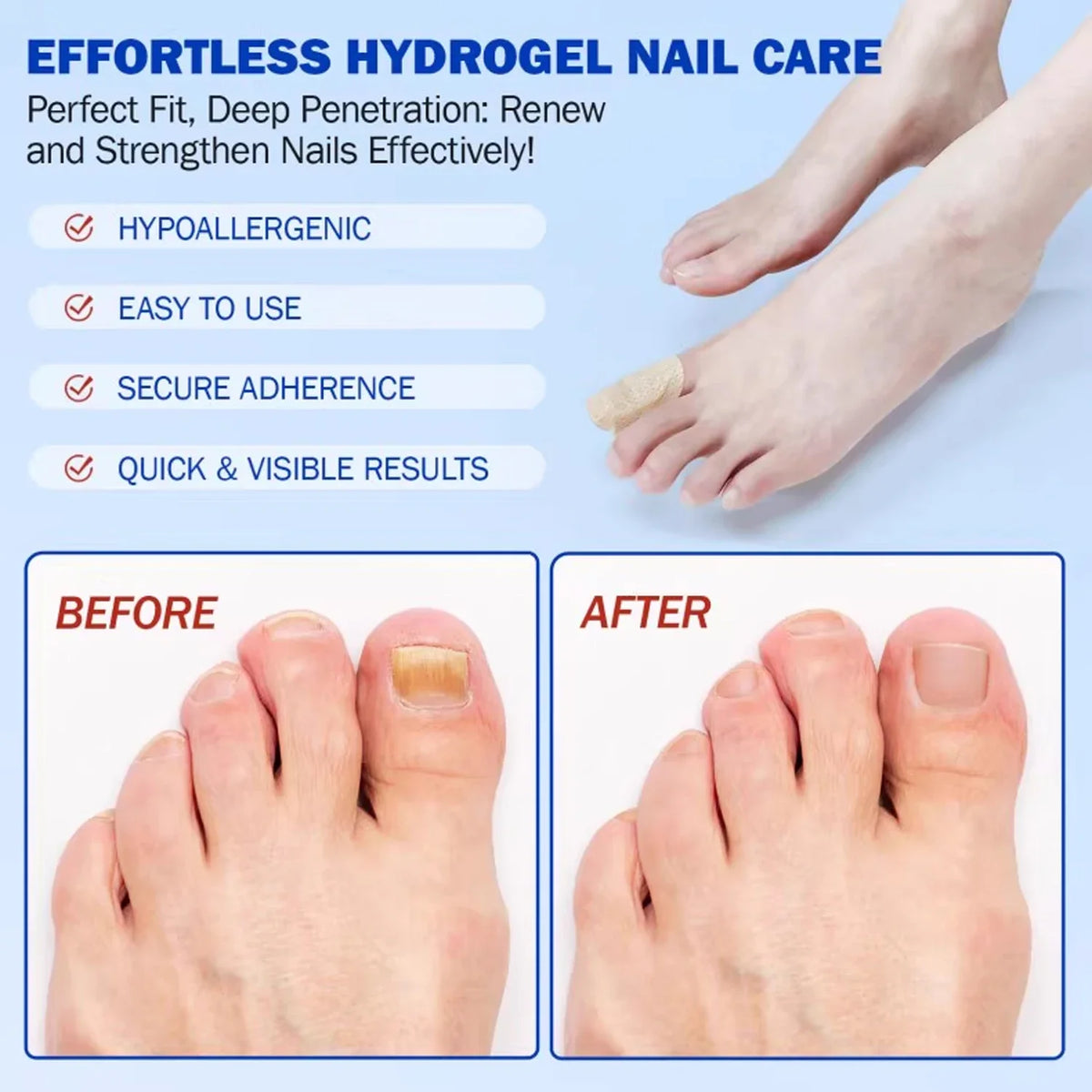 Before and after images showing the application of effortless hydrogel nail care for toenail health.